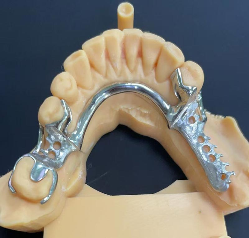 مزایای چارچوب کبالت کروم (چارچوب Co Cr)