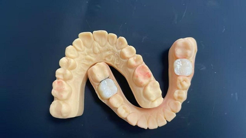 لبه شانه چیست؟