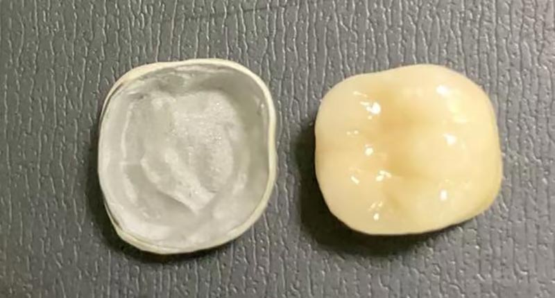 آزمایشگاه دندانپزشکی WM - یک آزمایشگاه دندانپزشکی چینی