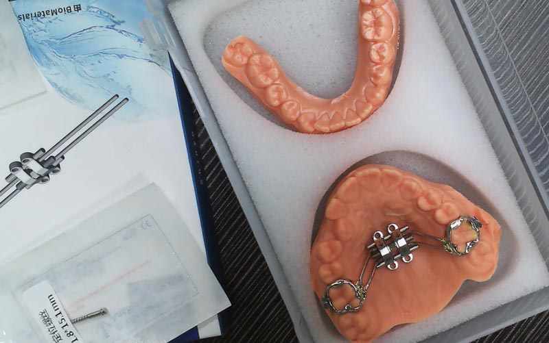 MSE Skeletal Expansion را با WM Dental Lab درک کنید