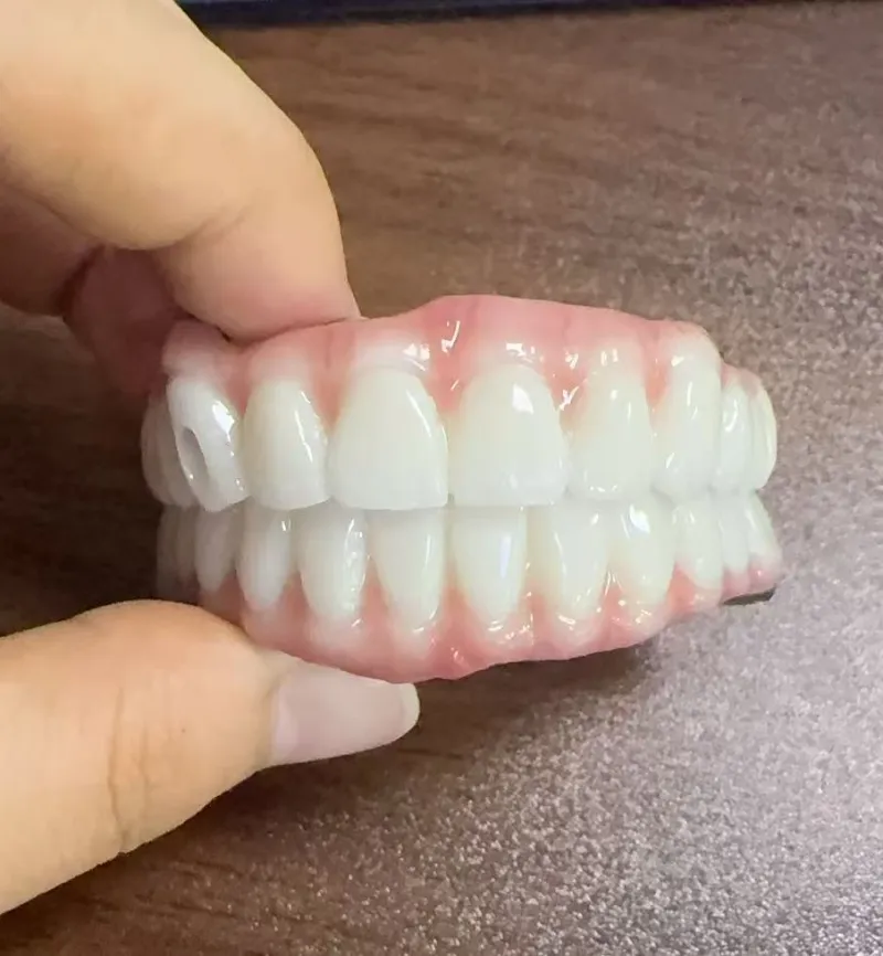 خطرات مال اکلوژن