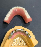 مکان یاب و نوار دندانپزشکی