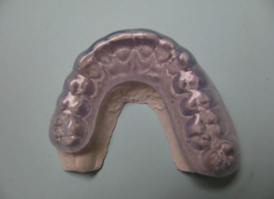 بریس اکلوزال