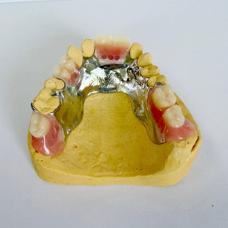 چارچوب جزئی بازسازی قابل جابجایی